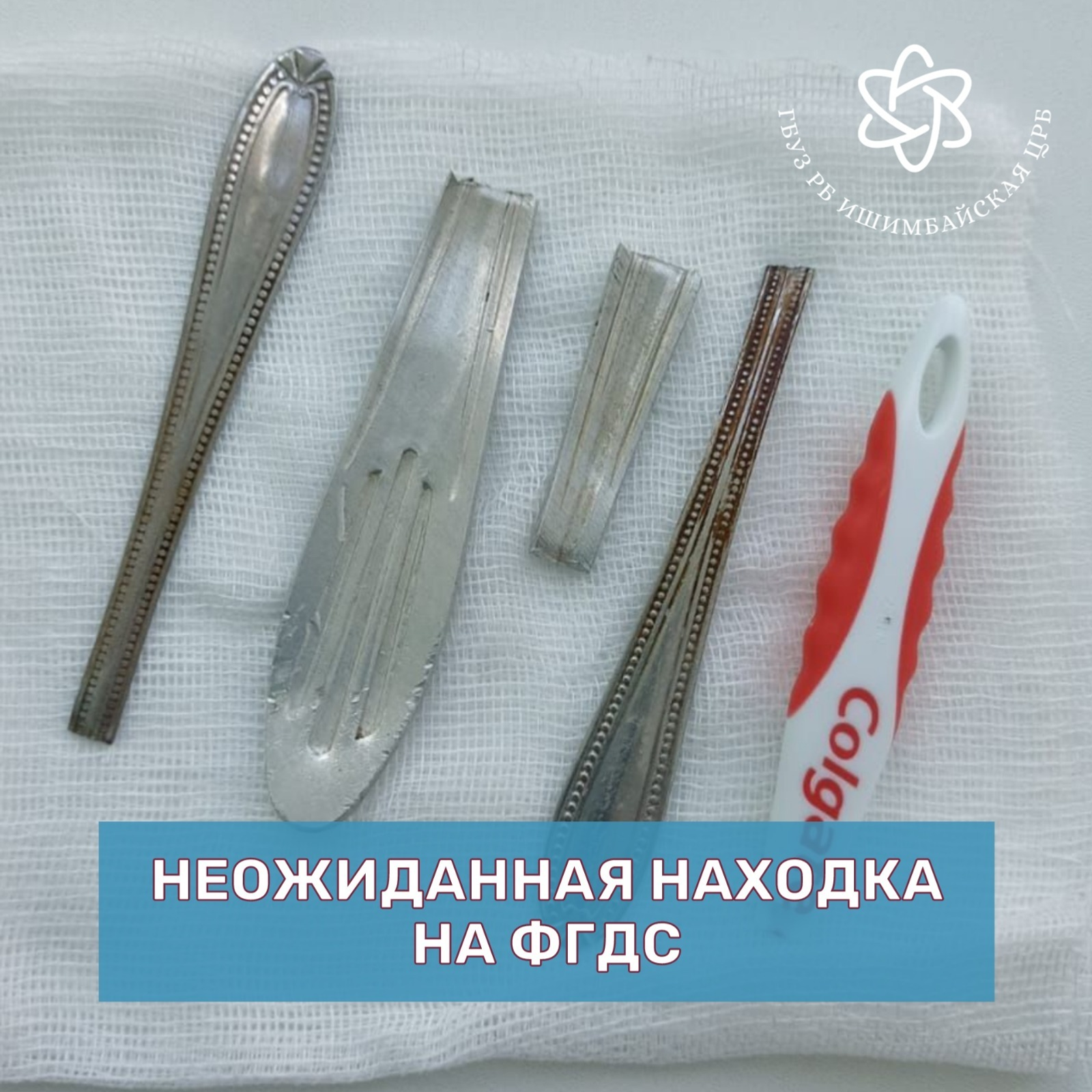 В Башкирии врачи вытащили из желудка пациента пять предметов