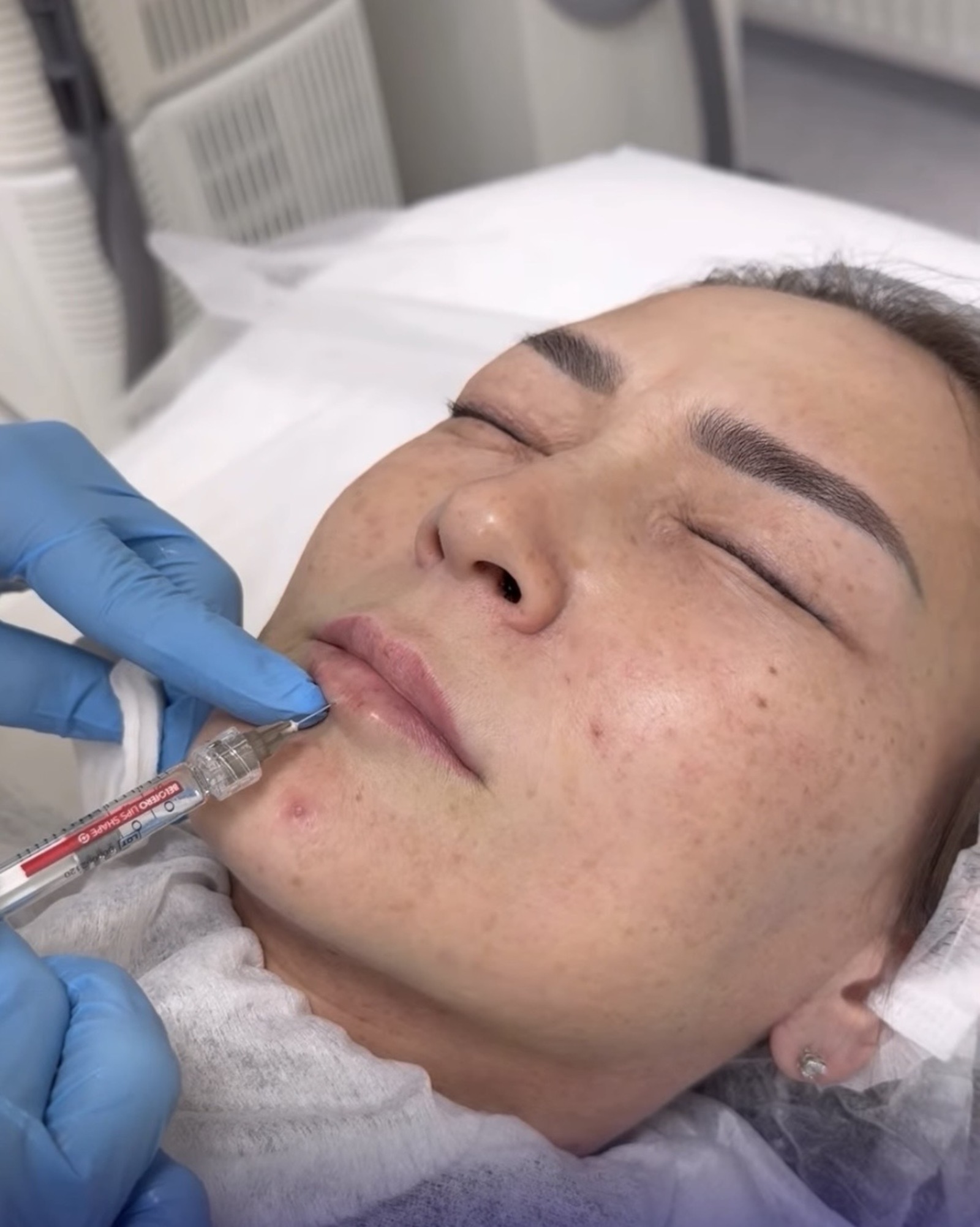 Блогер «Башкирская домохозяйка» решилась на новую операцию