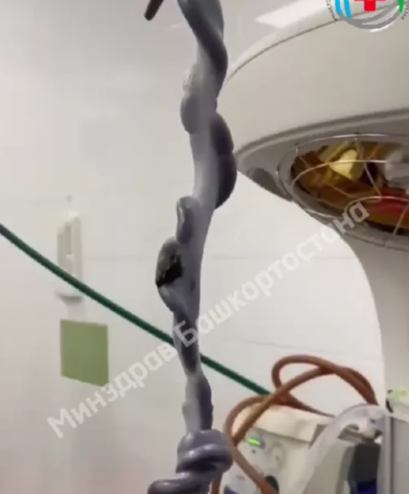 В Башкирии родился уникальный ребенок