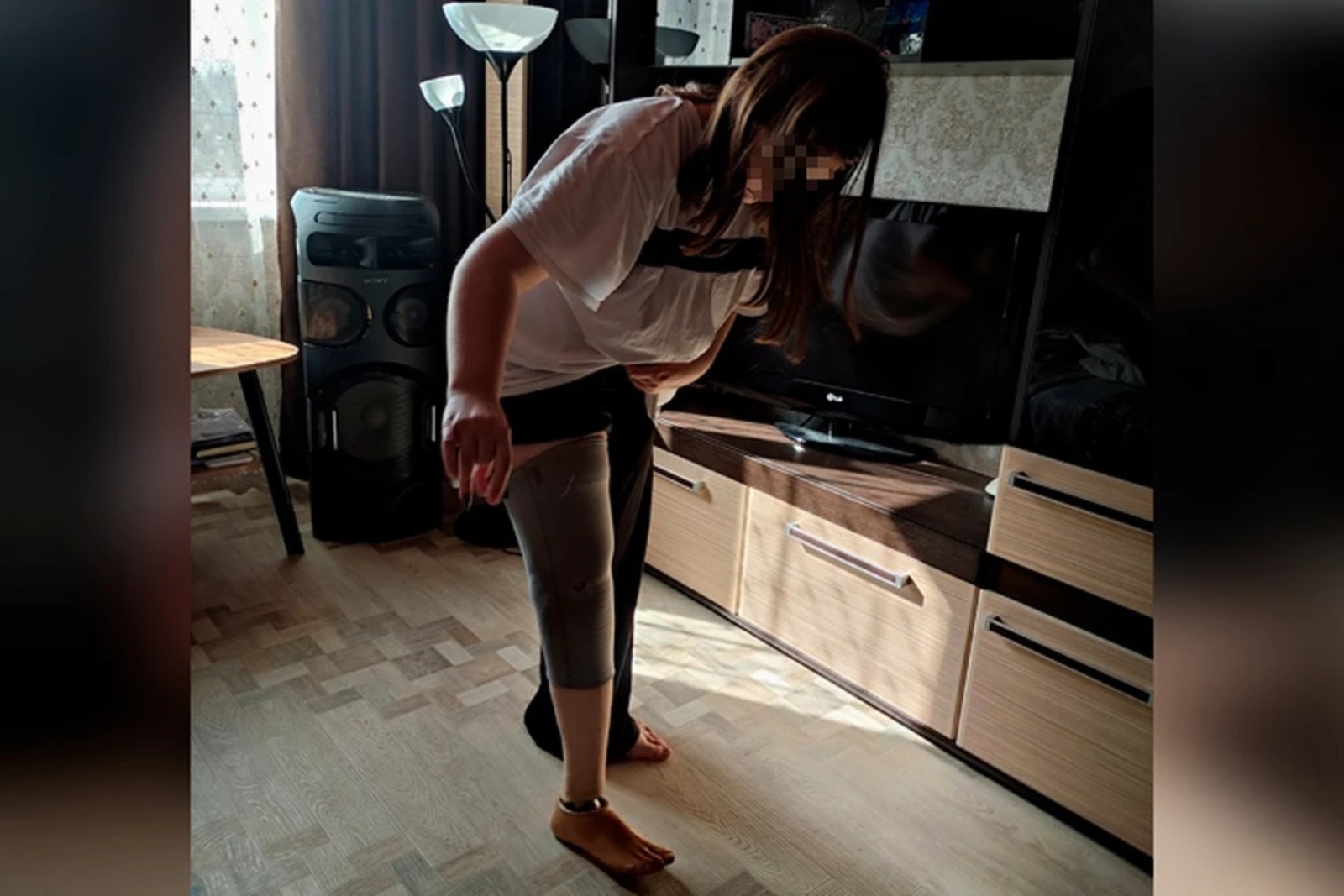 «Больно видеть, как мучается дочь»: в Башкирии 15-летняя школьница, родившаяся без ноги, не может получить бесплатный протез