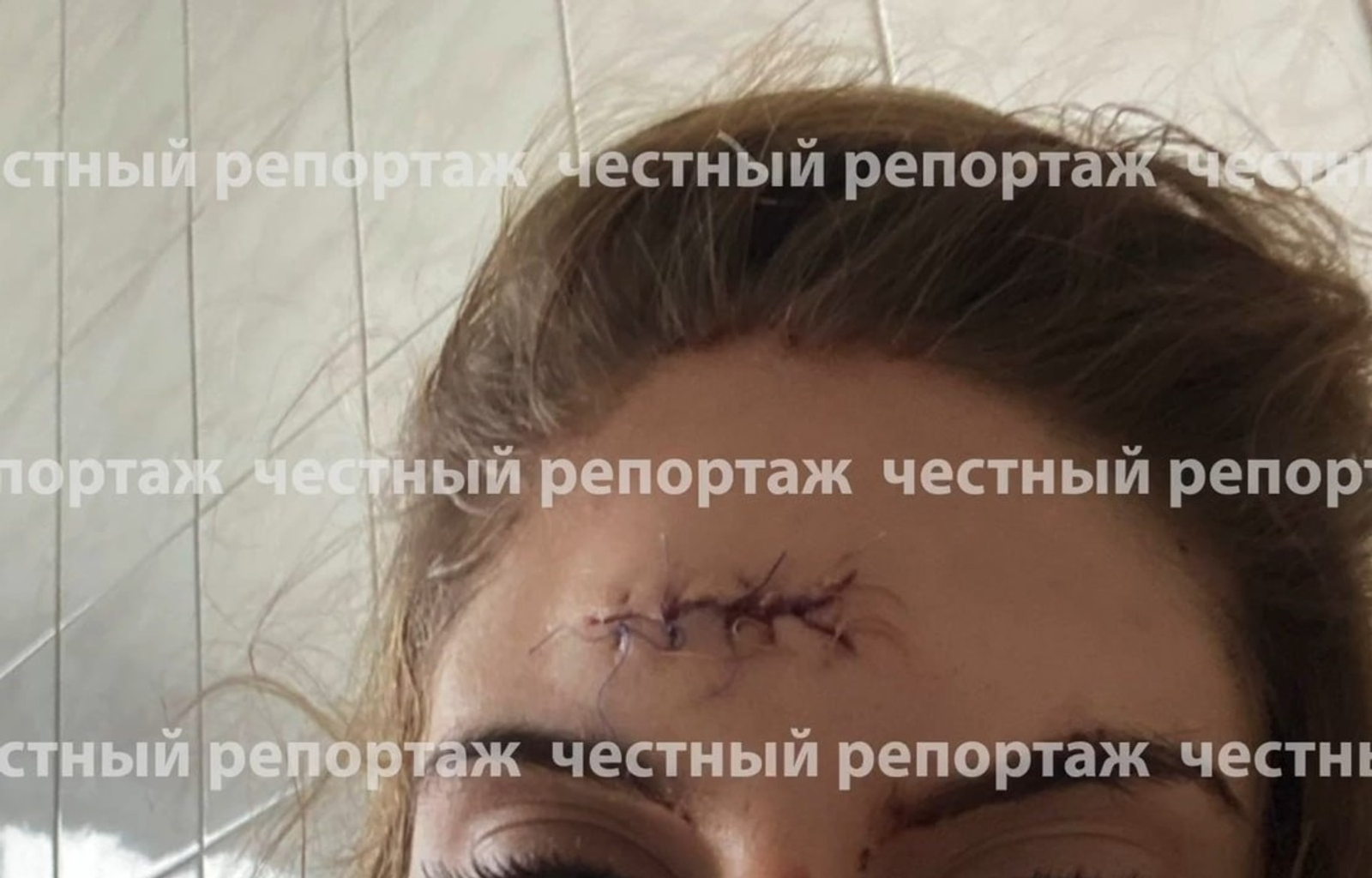 В Башкирии «неприличную женщину» столкнули с лестницы