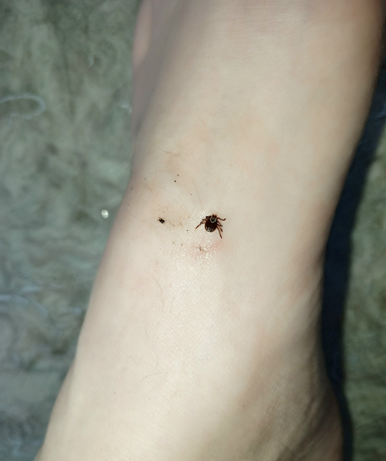 Клещи проснулись:  осторожно!